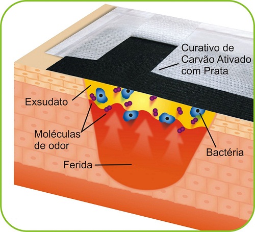 Imagem Curativo Curatec Carvão Ativado com Prata Sachê