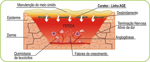 Imagem Pomada Curatec Hidrogel 30g