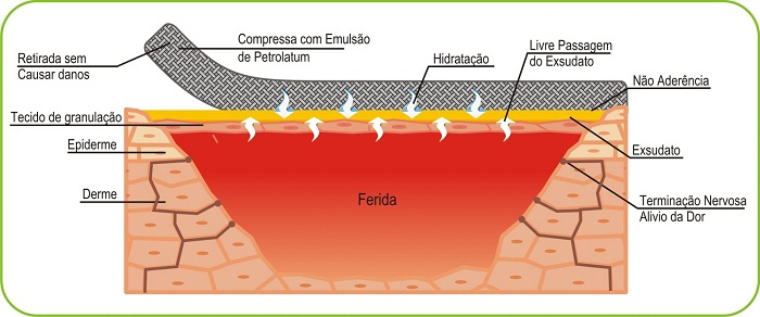 Imagem Curatec Compressa com Emulsão de Petrolatum