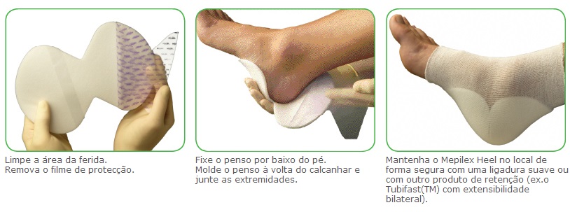 Como Aplicar Curativo Mepilex Heel de Silicone para calcanhar