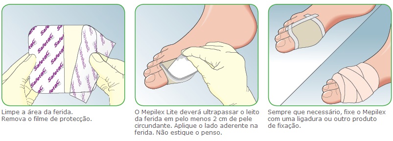 Como Aplicar Mepilex Lite de silicone