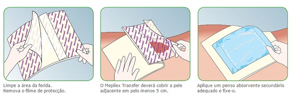 Curativo Mepilex Transfer